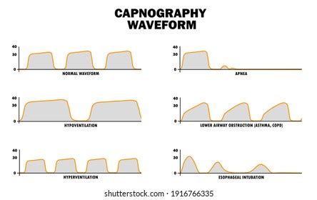 capnography images stock  vectors shutterstock