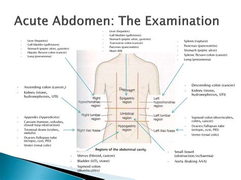 acute abdomen  peritonitis prezentatsiya onlayn