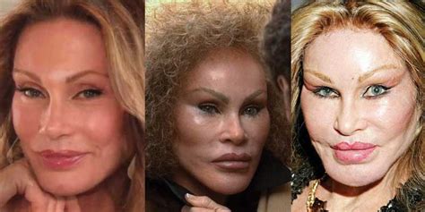 Jocelyn Wildenstein Plastic Surgery Before And After