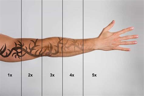 tattoo removal facts  questions   wrong bad habits tattoos