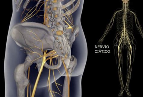 4 Simple Exercises To Heal Sciatic Nerve Pain Daily