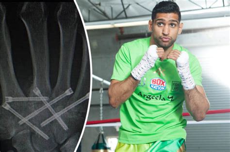 Boxer Amir Khan Has Hip Bone Put In His Fist Daily Star