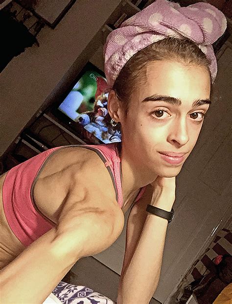Anorexic Teen Ballet Dancer Drops To Four Stone After