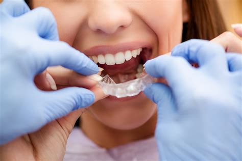 invisalign tips  orthodontic patient