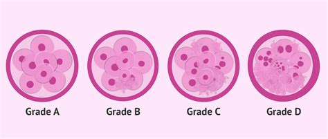 classification criteria  categories    embryo quality
