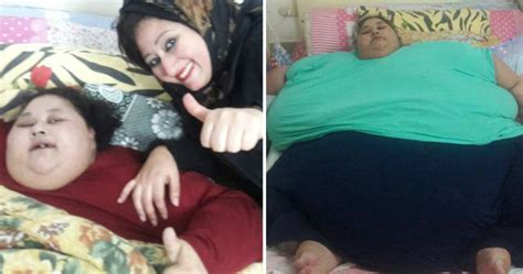 world s fattest woman lost 5st in a week before lifesaving operation
