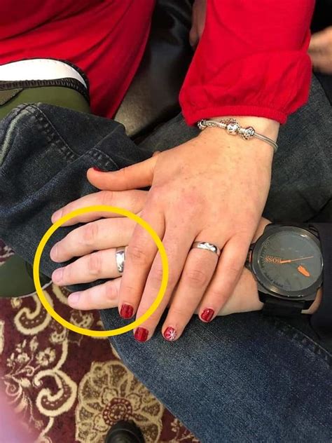 Newlywed S Finger Ripped Off As Wedding Ring Gets Caught