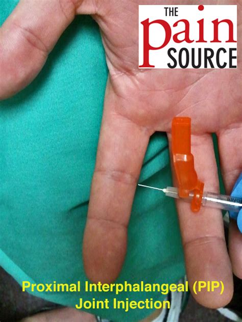proximal interphalangeal joint injection technique  tips