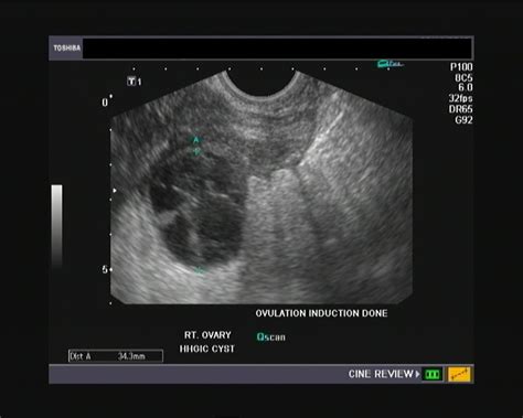 a gallery of high resolution ultrasound color doppler and 3d images