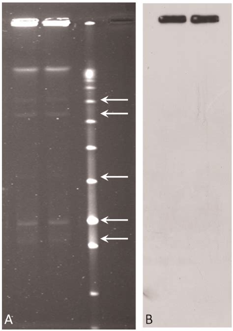 Pfge And Hybridization Analysis A Pulsed Field Gel Electrophoresis