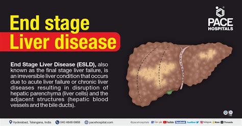 stage liver disease symptoms  complications