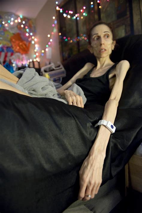 ‘it s hell san clemente woman s video shines light on adult anorexia