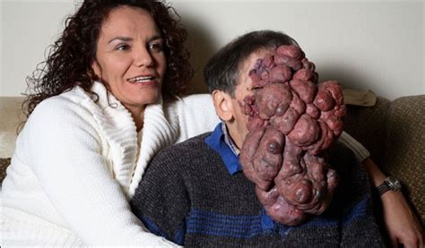 10 people with shocking and extreme deformities listverse