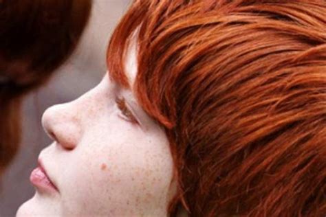 skin cancer and health concerns for redheads