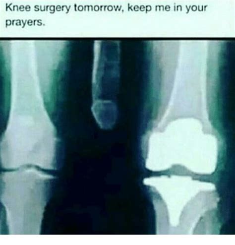 image result for knee surgery meme xray knee surgery twisted humor funny