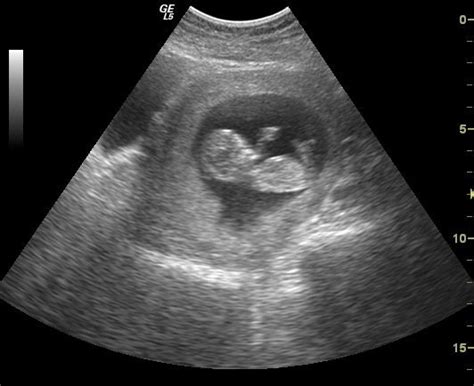 ultrasound and pregnant stock porn