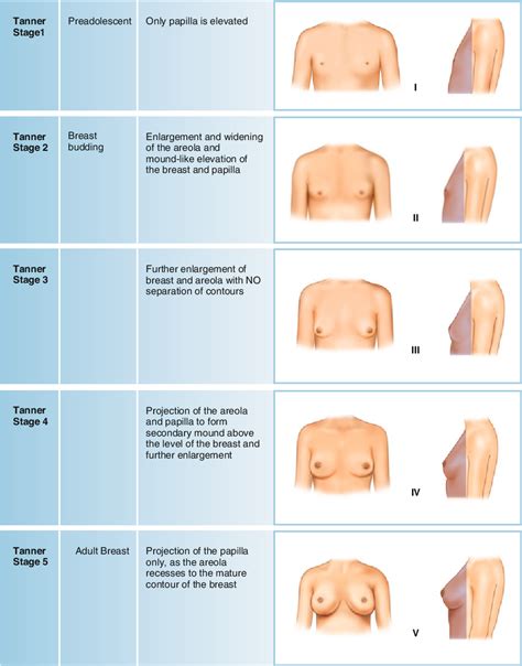 tanner2 breastandtanner stage