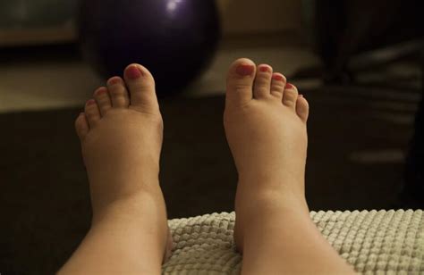 when to see a doctor for swollen feet treatment