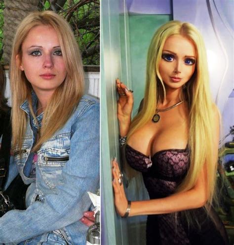 Barbie Plastic Surgery Girl Before And After Pictures