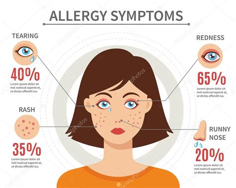 síntomas de alergia concepto de estilo plano — vector de stock