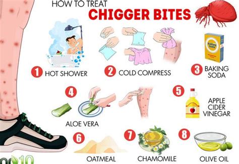 chigger bites pictures treatment   home remedies