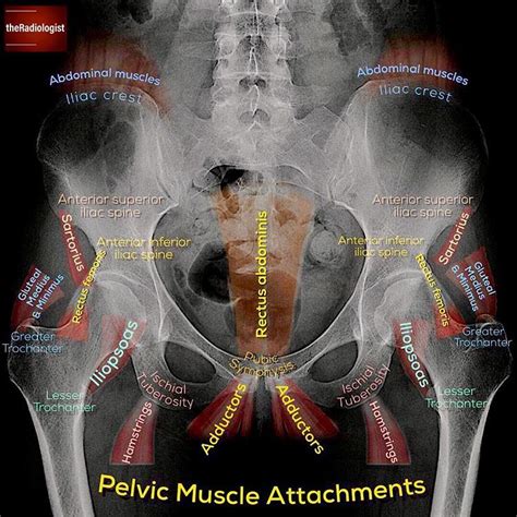 👨🏽‍💻want To Learn A System For Reviewing A Pelvic X Ray Read On To