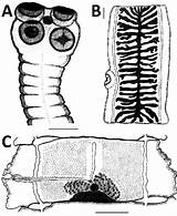Taenia Saginata Scolex Tapeworms Strain Proglottid Gyda Gravid Asiatica sketch template