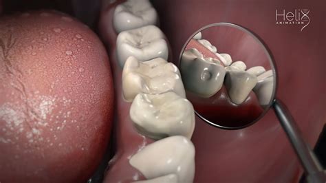 Oral Cavity And Realistic Teeth 3d Visualization Youtube