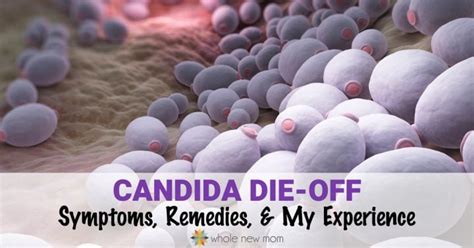 candida die    avoid manage   story