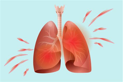 lung disease   deadly  rheumatoid arthritis patients