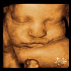 baby   belly dd ultrasound    reviews