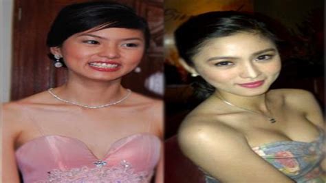 Pinoy Top List Top Pinay Celebrities Who Underwent