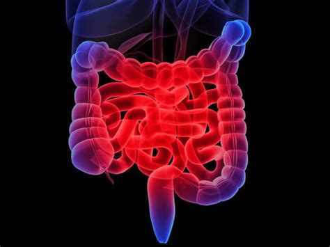 bowel problems symptoms    risk factors