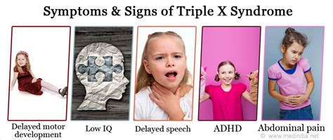 Triple X Syndrome Causes Symptoms Diagnosis Treatment And Prevention