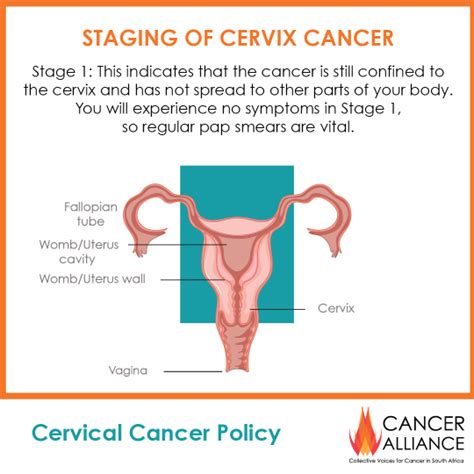cervical cancer policy 4 timely treatment and palliative care for