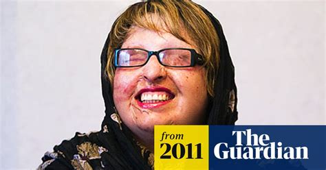 iranian woman blinded by acid attack pardons assailant as he faces same