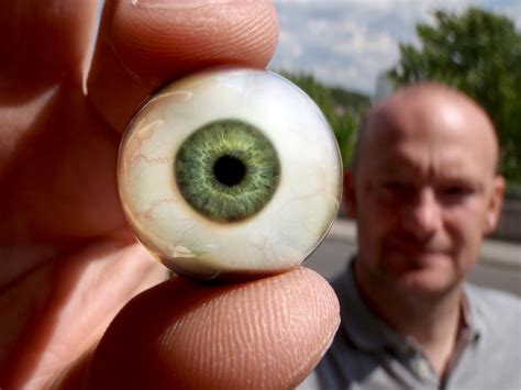 Artificial Eyes How These Can Help After Eye Removal Surgery