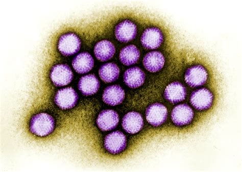 picture colorized transmission electron micrograph adenovirus
