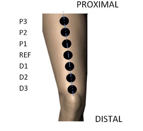 motor placement  anterior thigh depicted  black circles   scientific diagram