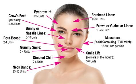 printable botox face chart