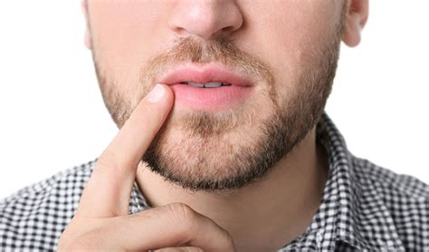 Signs Of Lip Cancer—four Symptoms To Know And How To Lower Risk And Tiege
