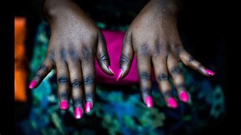 dermatologists warn nigerians  dangers  skin bleaching features  guardian nigeria