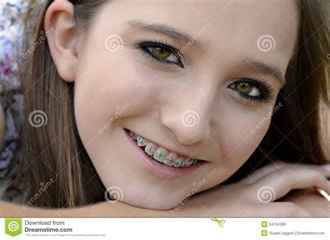 teen with braces porn archive