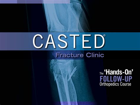 casted fracture clinic casted  hands  orthopedic courses