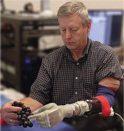 prosthetic arm   feel biomedical engineering  college  engineering