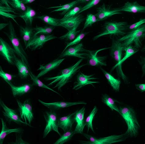 sir tubulin kit  cell microtubule probe spirochrome