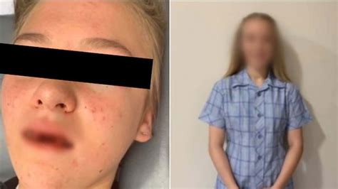 Bullied Adelaide 13 Year Old Speaks Out About Her Attack And Fear Of