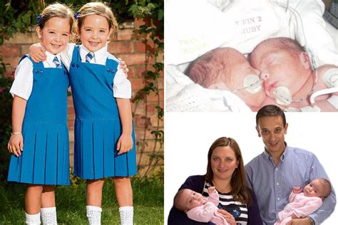 Mum S Joy As Her Miracle Conjoined Twin Daughters Defy The Odds And