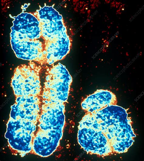 Human Sex Chromosomes X And Y Sem Stock Image C050 1129 Science