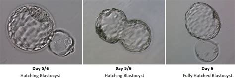 embryo development  ivf wilcox fertility pasadena fertility doctor